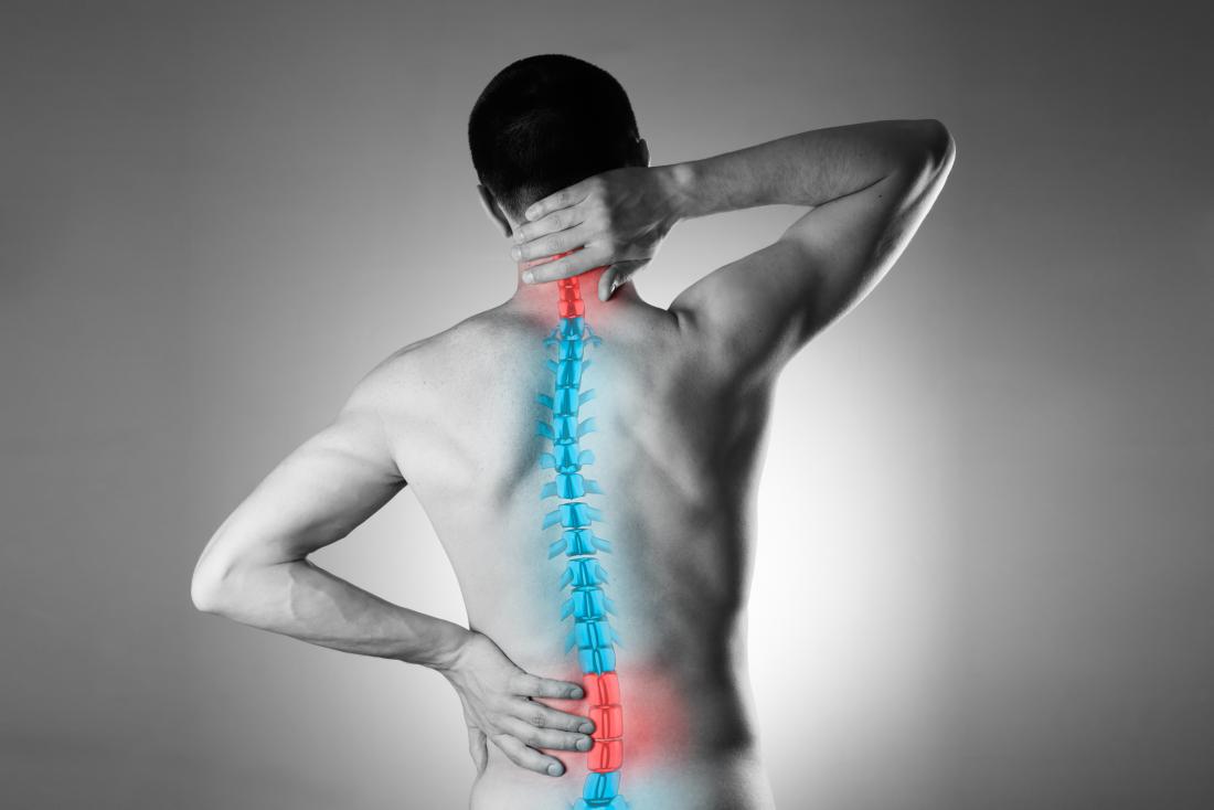 PSA Docs - Low Back Pain